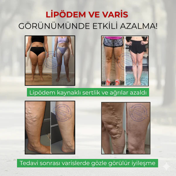 3'Lü Etki Taytı Lipödem, Selülit, Varis