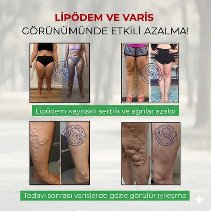 3'Lü Etki Taytı Lipödem, Selülit, Varis